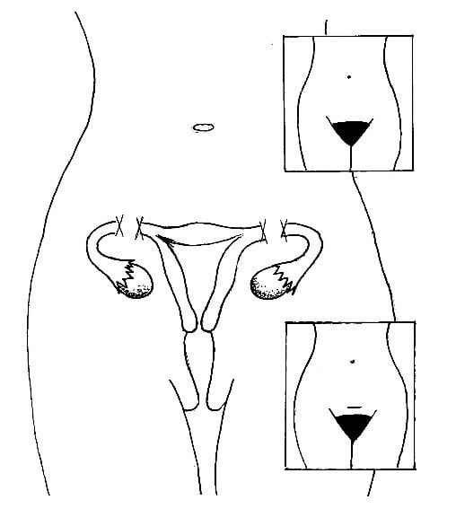 Atención médica ginecológica a las mujeres de las comunidades de El Viejo